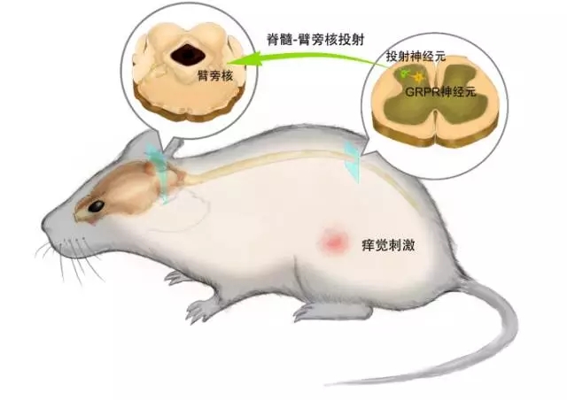 研究發(fā)現(xiàn)控制癢的GRPR神經(jīng)元 撓不撓它說(shuō)了算